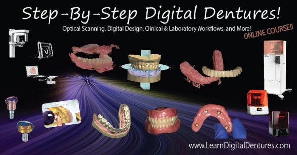 Michael Scherer - Step-by-Step Digital Dentures